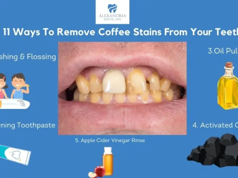 How to Remove Coffee Stains From Teeth: 5 Proven Methods